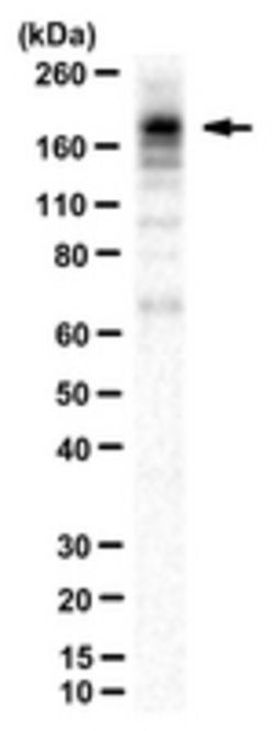 MAP-2 Rabbit anti-Mouse, Rat, Polyclonal, MilliporeSigma 100 &mu;g | Buy Online | MilliporeSigma | Fisher Scientific